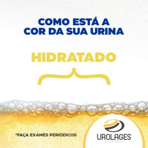 Clinica Urolages, Cor da Urina