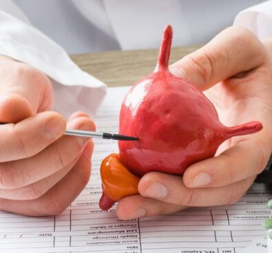 Cancer de Bexiga - UROLAGES Telêmaco Borba