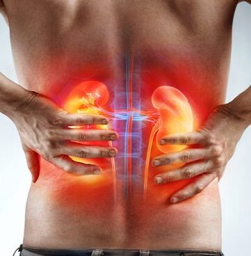 Câncer de Rim: Entenda os Sintomas, Diagnóstico e Tratamentos Modernos